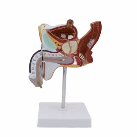 Diseased Male Genital Organs Anatomical Model 2 Parts Medical Science PNT-0744