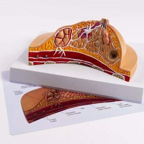 Breast Anatomy Model Teaching Aids Female Breast Structure Medical Beauty Salon Props Pathology Breast Dissection Teaching Gift